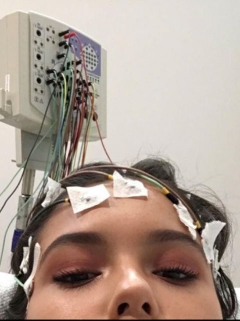 Jayda-Leigh Brailey wired up to an EEG scan