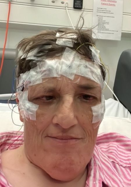 Kate Green in hospital with EEG electrodes during epilepsy monitoring and diagnosis