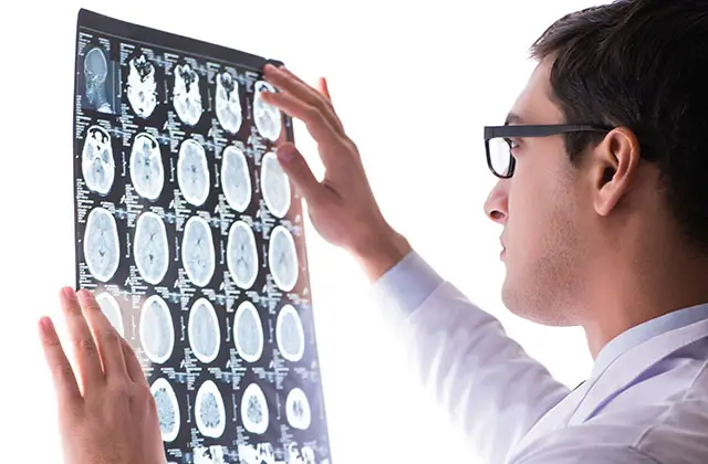 Doctor examining brain scan images for epilepsy diagnosis