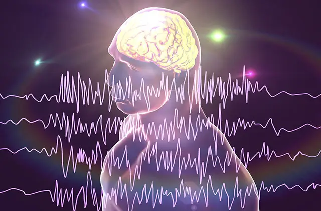 Illustration of brain with electrical activity representing seizure causes