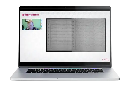 Free epilepsy academy online course displayed on laptop screen for epilepsy education and training