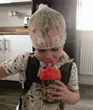 Young Harry undergoing EEG brain monitoring with electrodes on head, part of epilepsy diagnosis and treatment